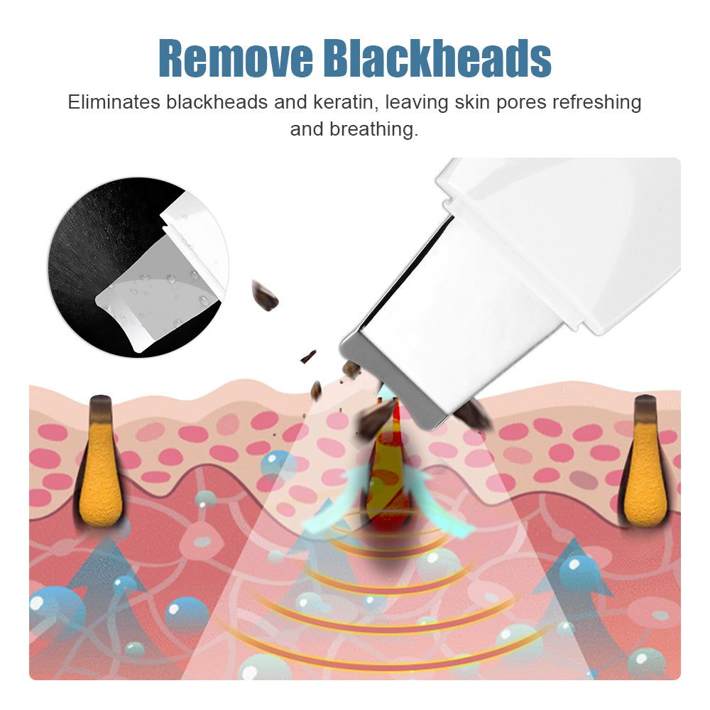 Ultrasonic Skin Scrubber – Deep Pore & Blackhead Cleaner