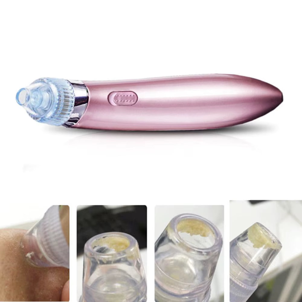 Vacuum Pore and Blackheads Cleaner – Deep Clean & Hydrate