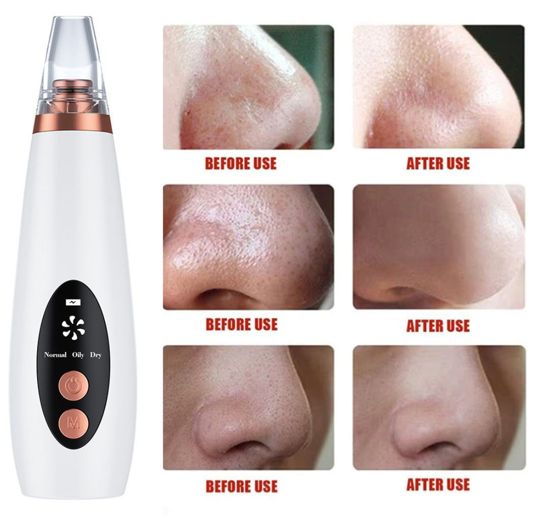 Vacuum Pore and Blackheads Cleaner pro