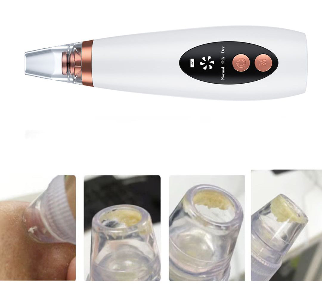 Vacuum Pore and Blackheads Cleaner pro