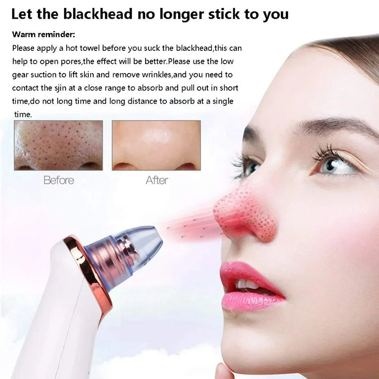 Vacuum Pore and Blackheads Cleaner – Deep Clean & Hydrate