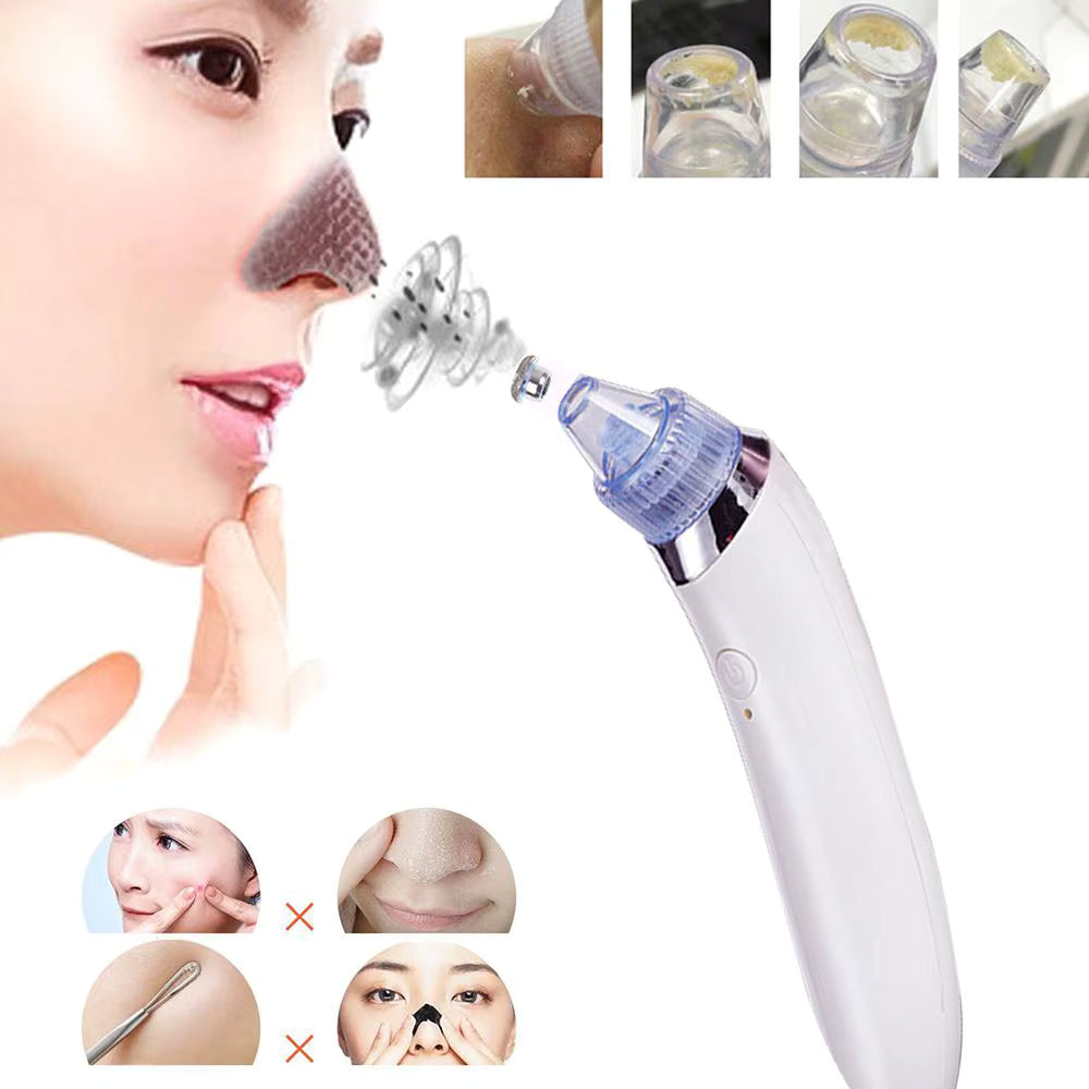 Vacuum Pore and Blackheads Cleaner – Deep Clean & Hydrate